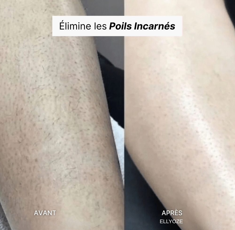 RASOIR 5-EN-1 ELLYOZE®