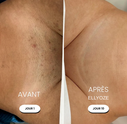 RASOIR 5-EN-1 ELLYOZE®