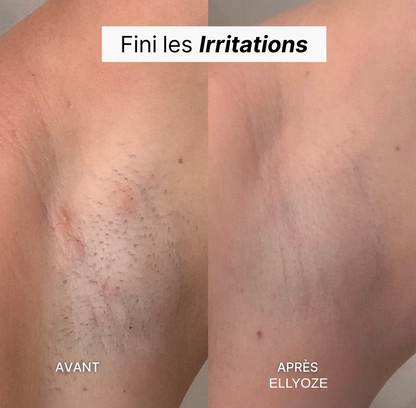 RASOIR 5-EN-1 ELLYOZE®